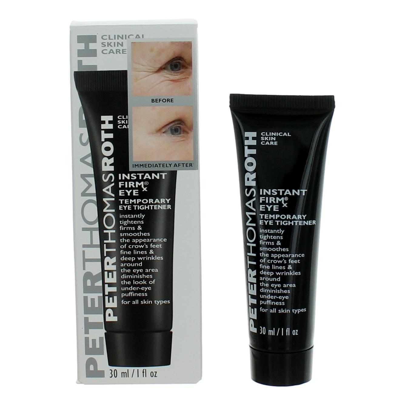 Peter Thomas Roth Instant FIRMX, 1oz Temporary Eye Tightener by Peter Thomas Roth